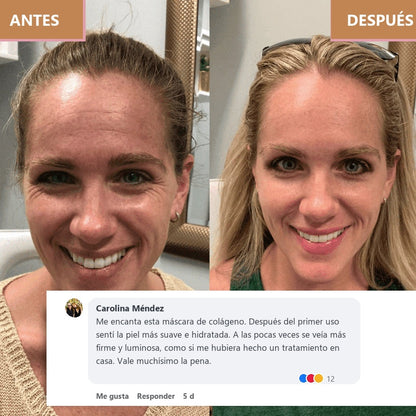 Resultado de una clienta con AURA