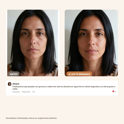 DAI colágeno — dai-carru-04