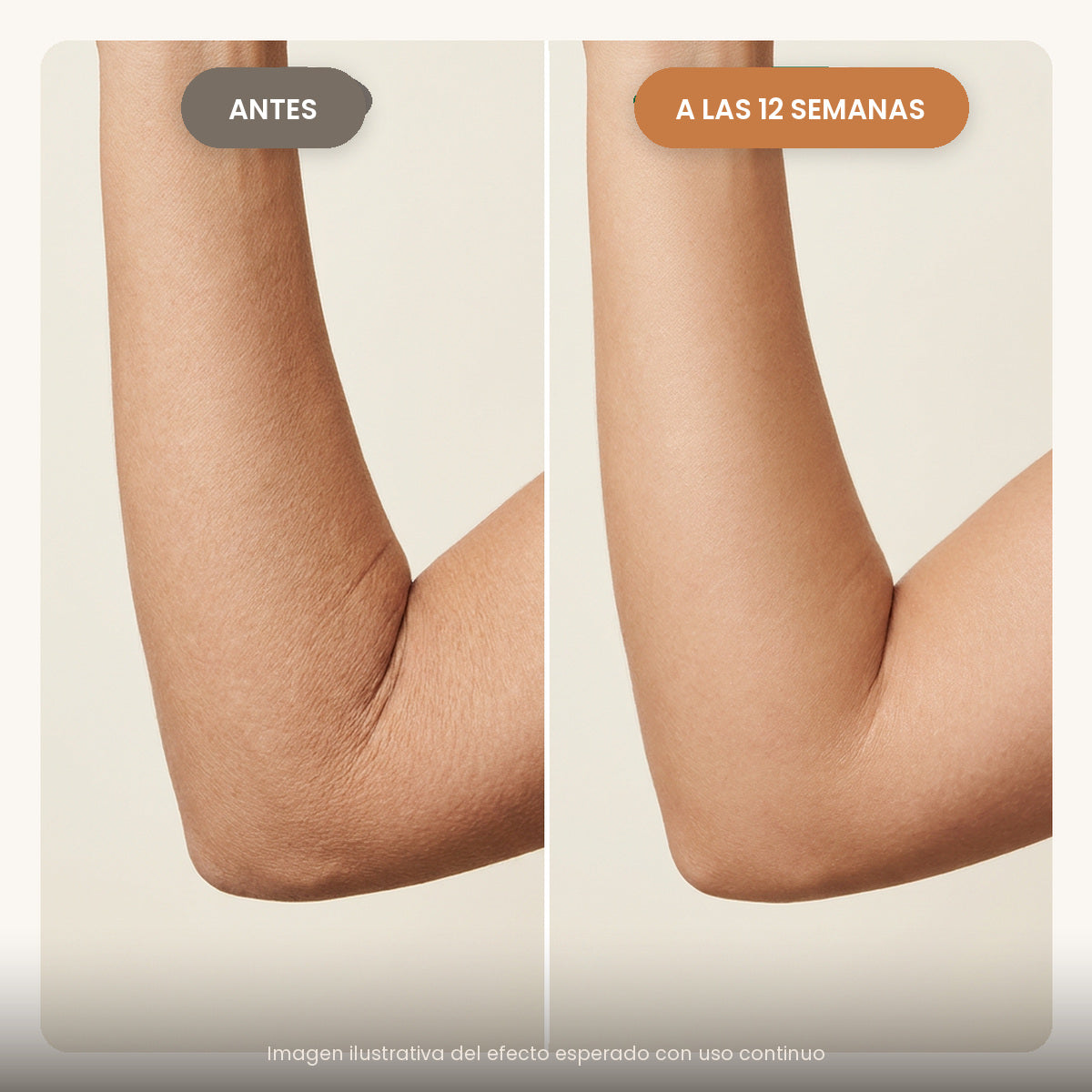 Brazo antes y a las 12 semanas de usar Firmeza Corporal